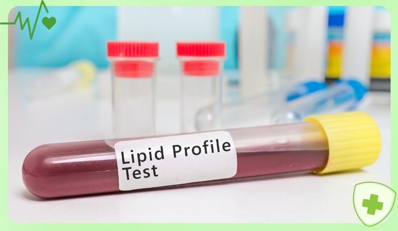 Xét nghiệm lipid máu trước khi lọc máu triglyceride tại Hà Nội Xét nghiệm lipid máu trước khi lọc máu triglyceride tại Hà Nội