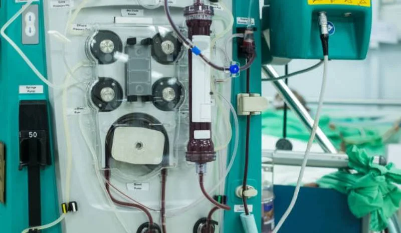 máy lọc máu hấp phụ